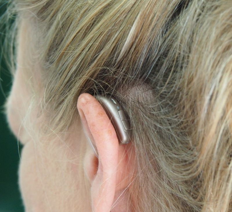 appareil auditif positionné sur oreille gauche - vue de derrière
